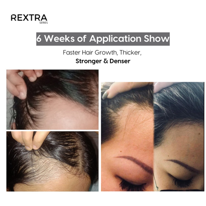 The Ultimate Hair Growth Elixir by Rextra Series | Powered by clinically studied ingredients